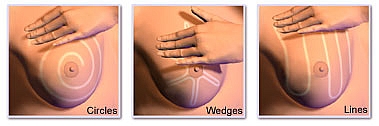 Womens health - Breast Examination