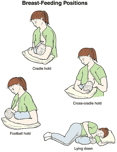Womens health - Breastfeeding