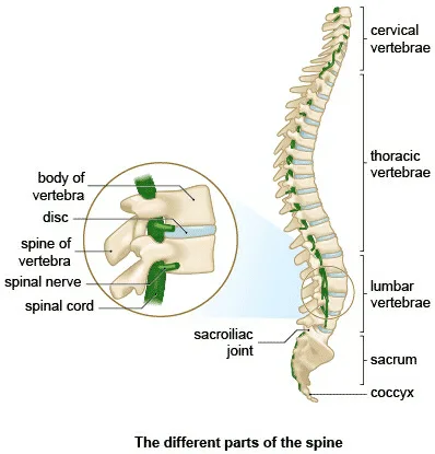Back pain