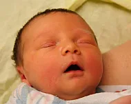 Colic