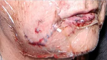 Dangerous dogs in the UK - Pit Bull Terriers