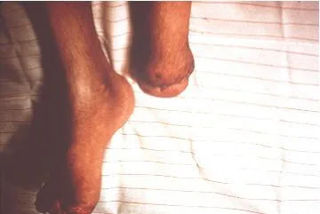 Smoking - why bother ?  Giving up smoking